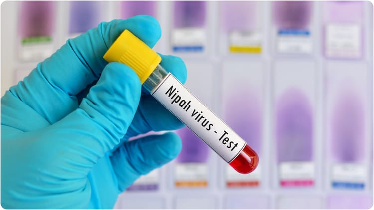 Nipah - Nipah Virus: बंगाल में निपाह वायरस से संक्रमित दो नर्सों में से एक की हालत ठीक, दूसरी गंभीर; निगरानी में सरकार
