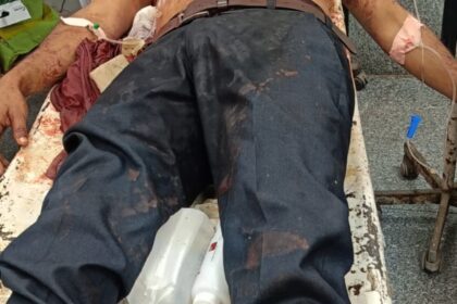 लखनऊ: - लखनऊ: बाइक सवार युवक के गले में फंसा चाइनीज पतंग का मांझा, नसें कटने से हुई दर्दनाक मौत