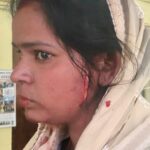 Lucknow - Lucknow : शराब के लिए रुपये न देने पर पिता, पत्नी और बेटे पर चला दी ब्लेड, पुलिस ने किया गिरफ्तार