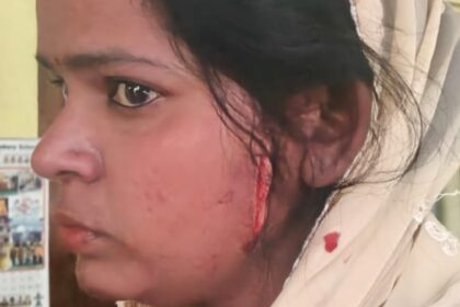 Lucknow - Lucknow : शराब के लिए रुपये न देने पर पिता, पत्नी और बेटे पर चला दी ब्लेड, पुलिस ने किया गिरफ्तार