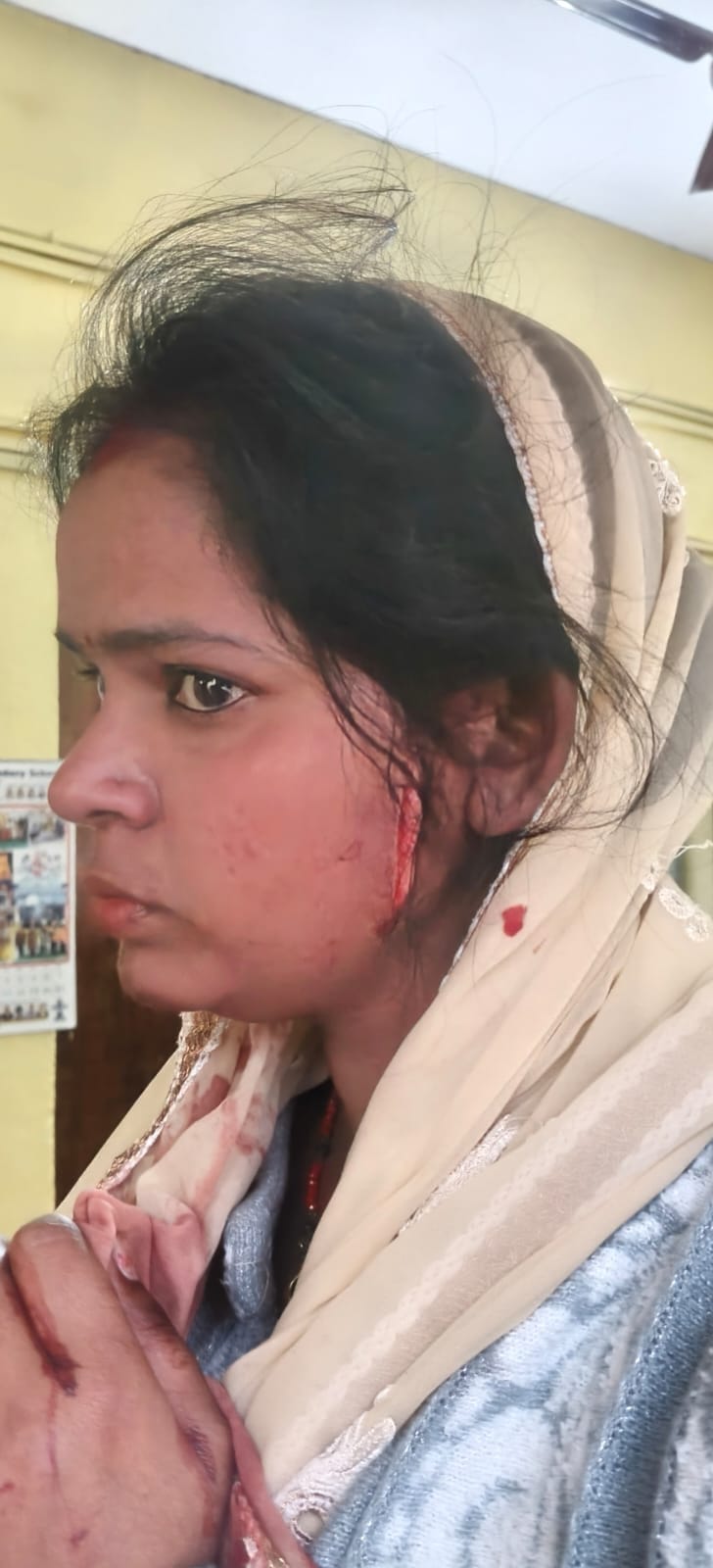 Lucknow - Lucknow : शराब के लिए रुपये न देने पर पिता, पत्नी और बेटे पर चला दी ब्लेड, पुलिस ने किया गिरफ्तार