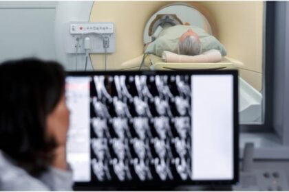 Science - Science Study: मेनोपॉज का असर दिमाग पर भी, याददाश्त कमजोर और चिंता-अवसाद का खतरा बढ़ा; MRI अध्ययन से खुलासा