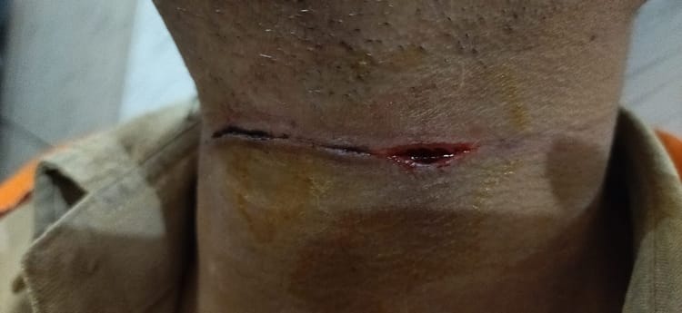 Lakhimpur - Lakhimpur Kheri News: चीनी मांझे की चपेट में आया युवक, गले में लगा गहरा कट