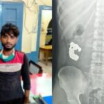 UP: बरेली - UP: बरेली में यक्ष एप से पकड़ा गया चोर, गिरफ्तार होते ही निगल गया चोरी का ब्रेसलेट; पुलिस ने कराया एक्सरे