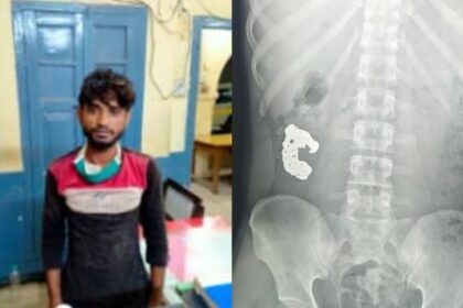 UP: बरेली - UP: बरेली में यक्ष एप से पकड़ा गया चोर, गिरफ्तार होते ही निगल गया चोरी का ब्रेसलेट; पुलिस ने कराया एक्सरे