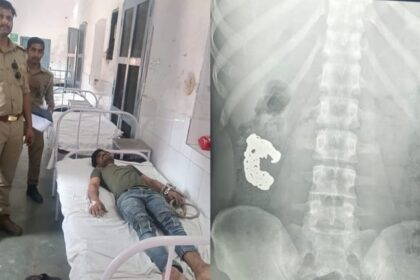 UP News: - UP News: बरेली में चोर ने निगला चांदी का ब्रेसलेट, पुलिस ने बरामदगी के लिए अपनाया ये तरीका