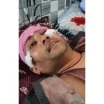 Hathras - Hathras News: कारोबारी से बदमाशों ने चार लाख रुपये लूटे, तमंचे की बट मार किया लहूलुहान