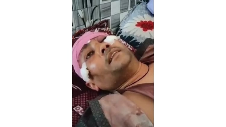 Hathras - Hathras News: कारोबारी से बदमाशों ने चार लाख रुपये लूटे, तमंचे की बट मार किया लहूलुहान